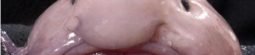 Blobfish