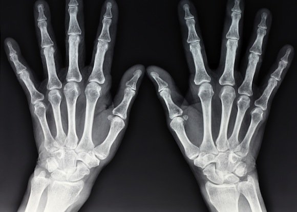 X –Ray
