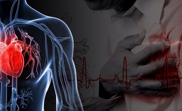 Ischaemic Heart Disease