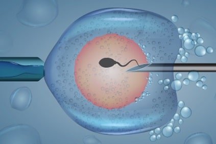 ivf