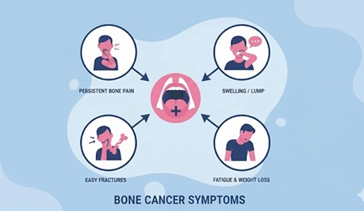 Bone Cancer Patients
